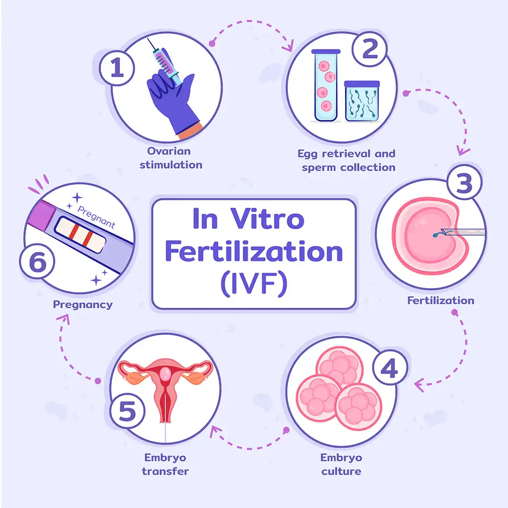 what-is-stimulated-ivf-treatment